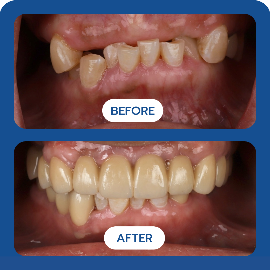 Before and After Case 3